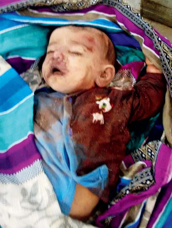 Ghatkopar Building Collapse: Baby Veronica suffocated to death under the debris