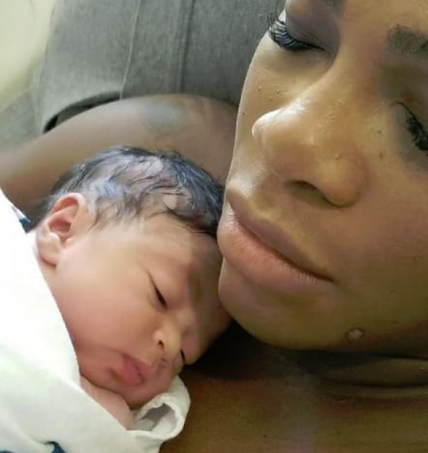 Serena Williams: Thanks Mother, Slams Body-Shamers in Open Letter