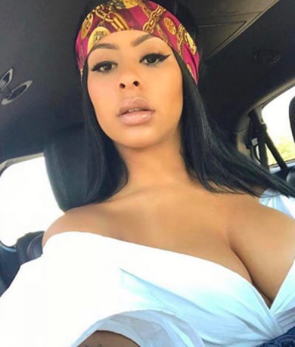 Alexis Skyy: Pregnant with Fetty Wap's Baby?!?
