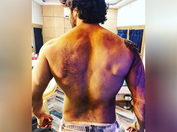 Kalank: Proof that Varun Dhawan has won the battle of scars 
