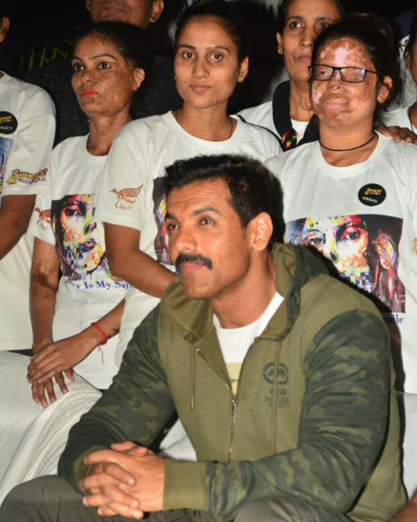  Check out: John Abraham meets up with acid attack survivors in Lucknow 