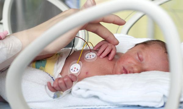 Premature babies more prone to heart failure during childhood and adolescence