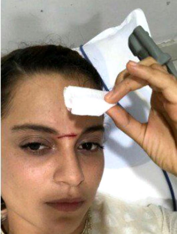 Kangana Ranaut: I am excited that my face was covered in blood
