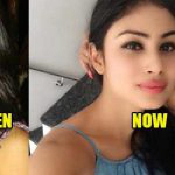 Here’s The List Of 10 TV Actresses Who Went Under Plastic Surgery!