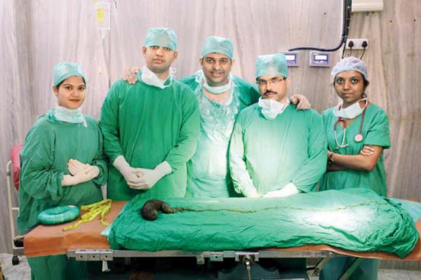 Mumbai: Doctors remove 750 grams of hair from woman's stomach