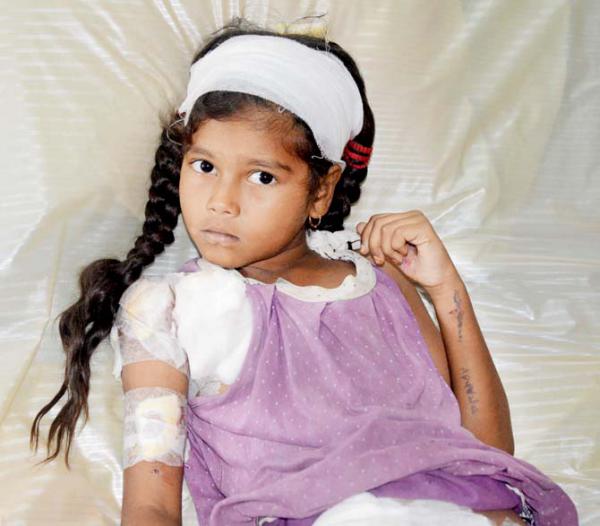 8-year-old girl mauled by 20 stray dogs at Arnala beach in Mumbai