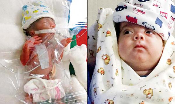 Mumbai: Born premature at 22 weeks, miracle baby set to go home