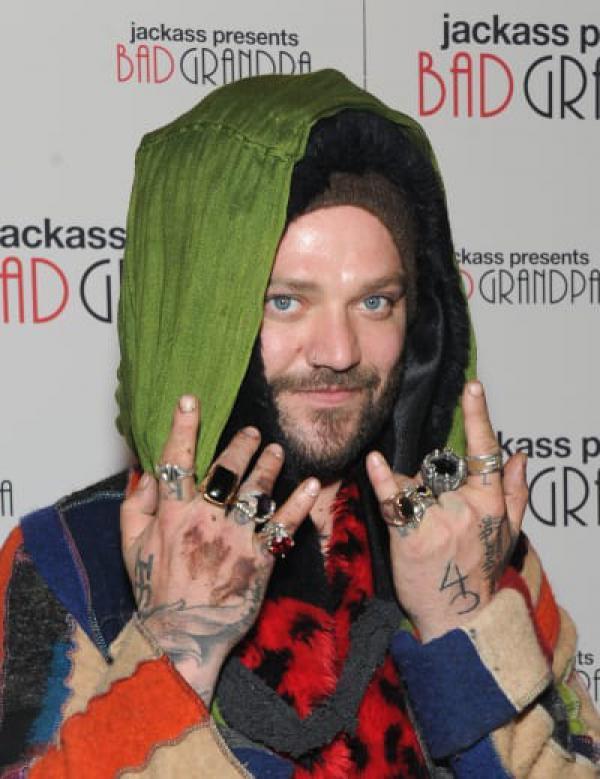 Bam Margera: Arrested For DUI In the Dumbest Way Possible